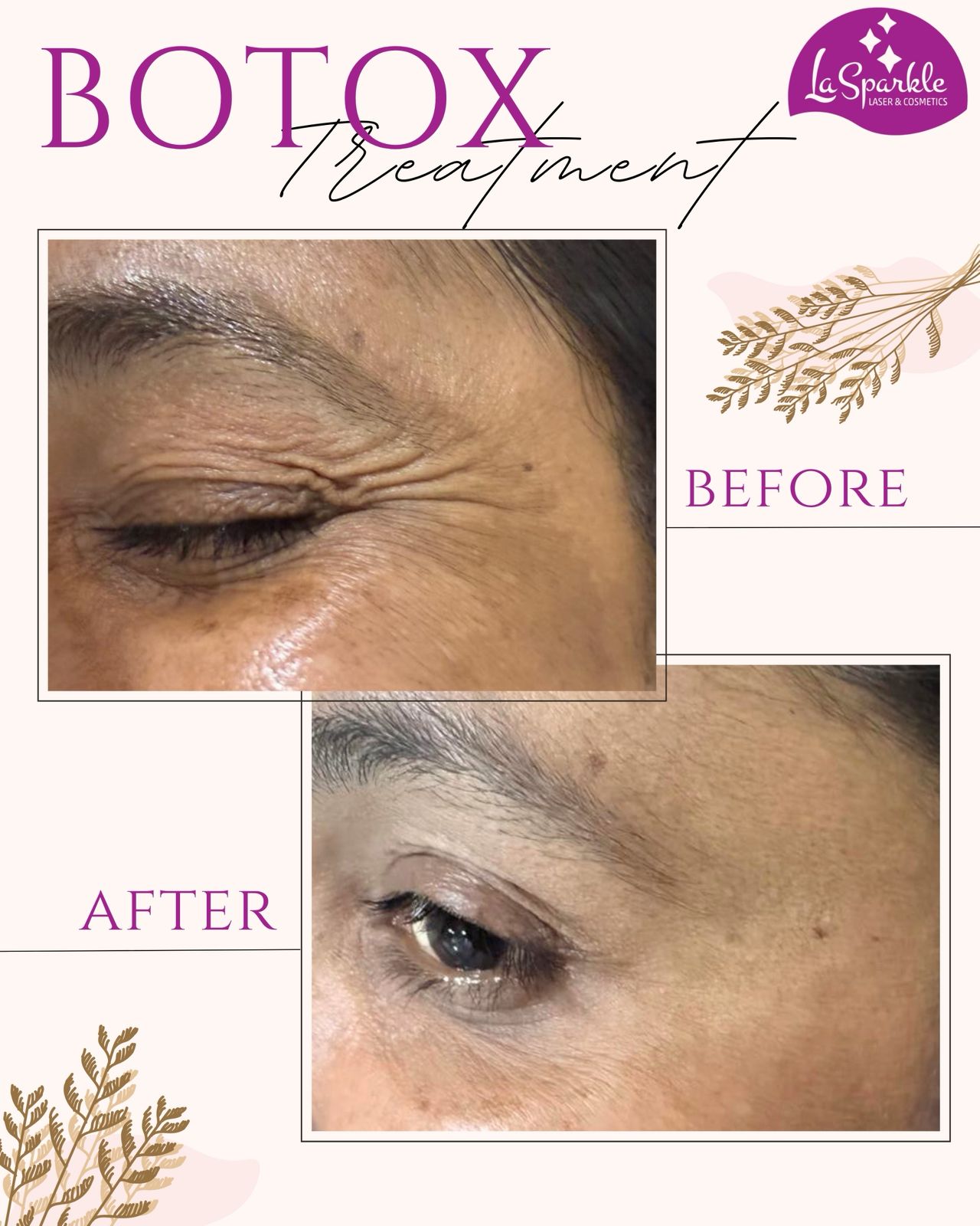 Laser hair reduction before and after arm skin details