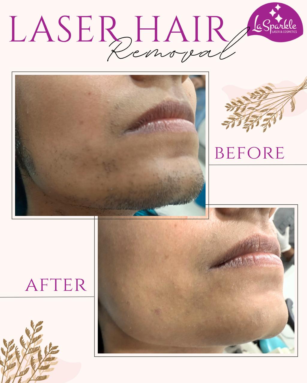 La Sparkle clinical skincare device and workspace