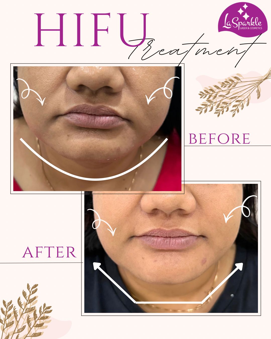 Advanced skincare clinic consultation room setup