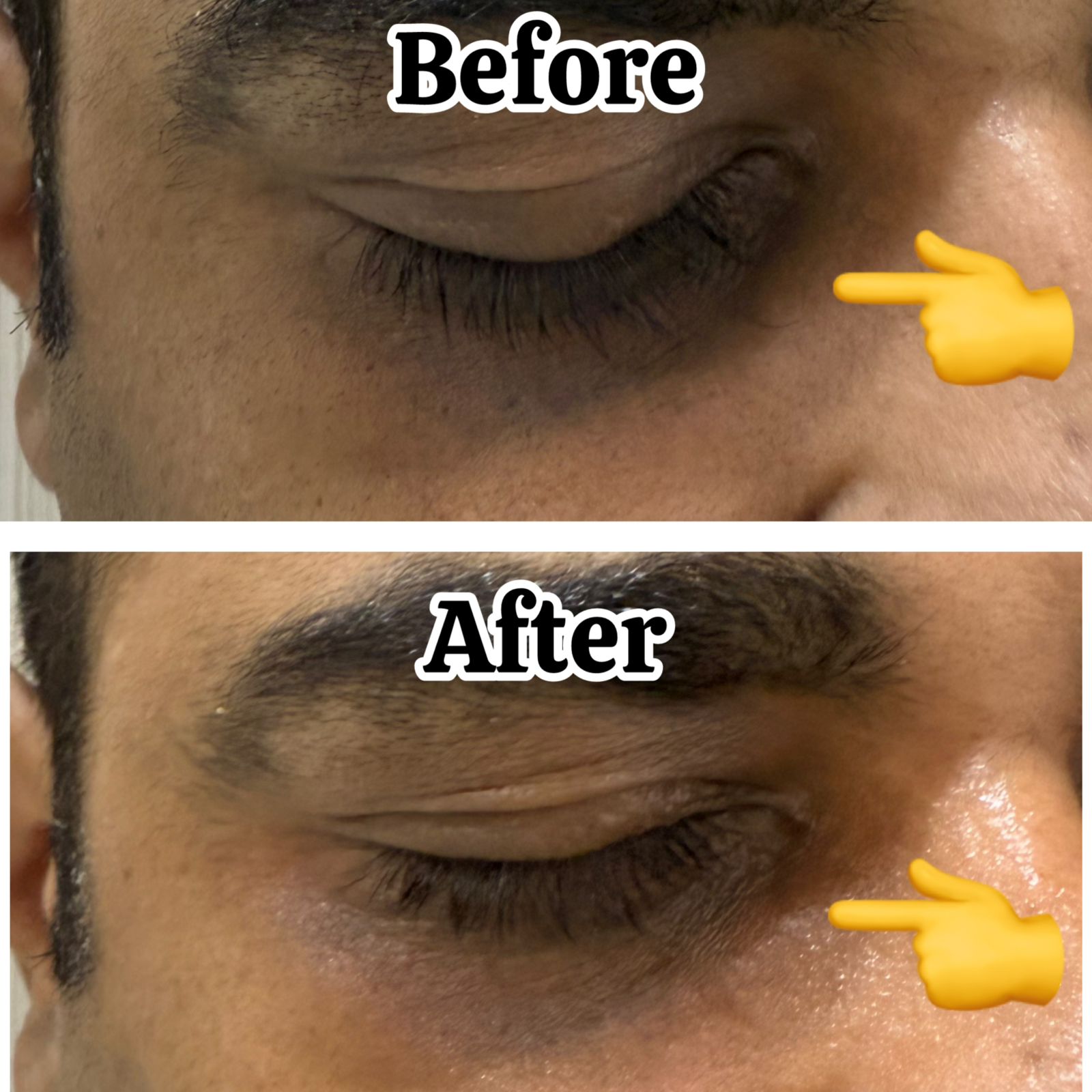 Luminous face glow and tan reduction after medical facial