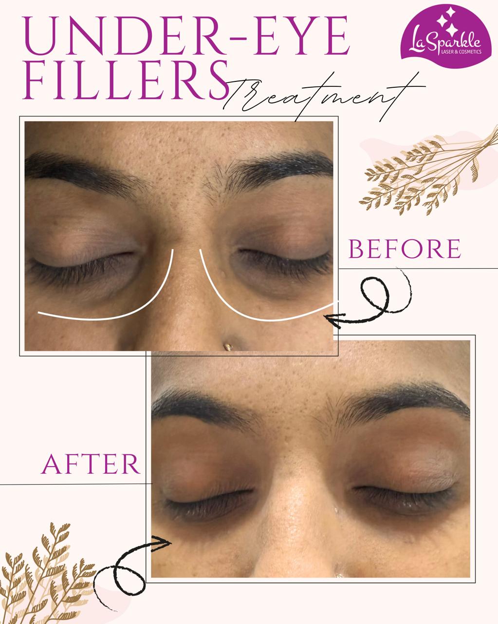 Forehead skin texture improvement and scar healing
